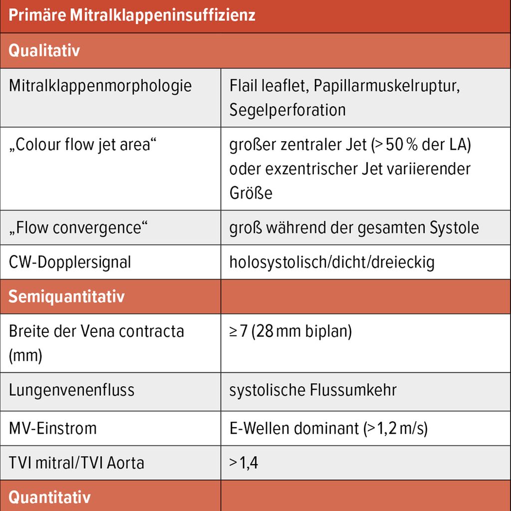 Quantifizierung & interventionelle Therapie der Mitralklappeninsuffizi